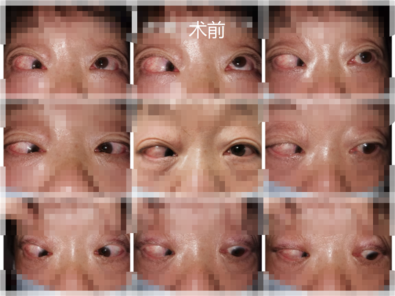 11.21.png