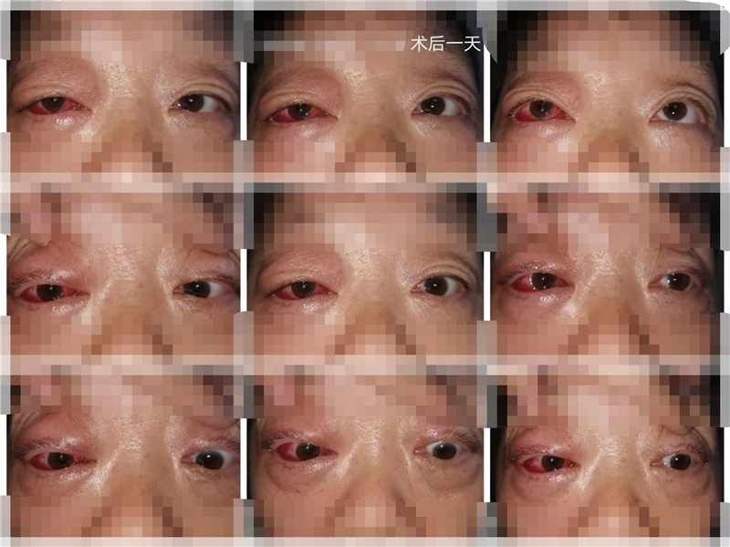 11.21-2.png