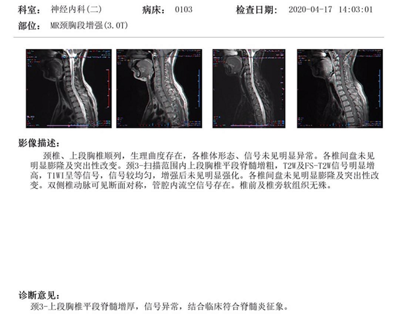 11.3治疗前.png 11.3治疗前.png