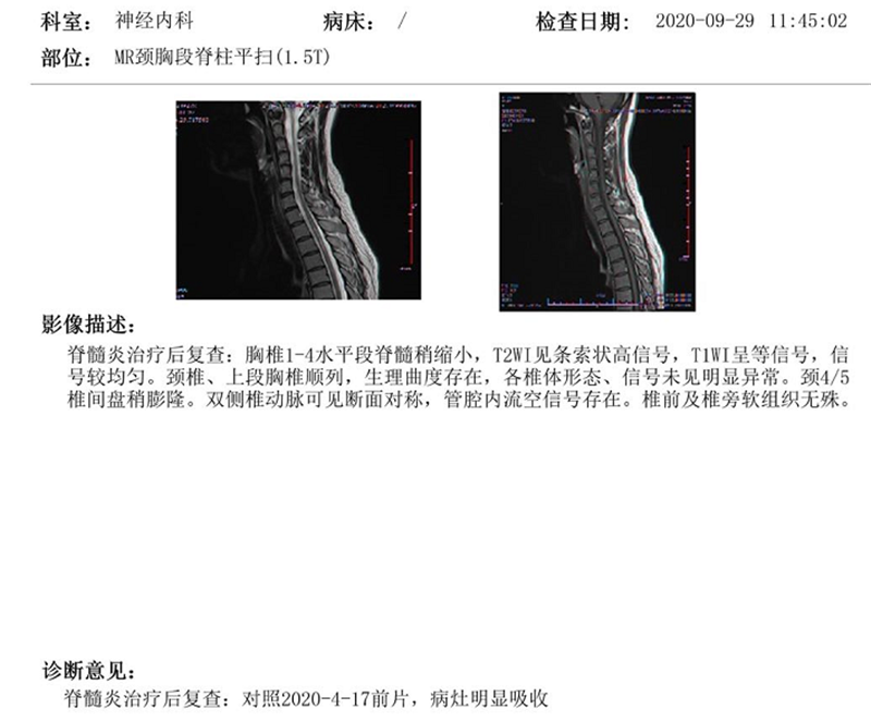 11.3治疗后.png 11.3治疗后.png