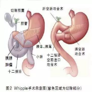 C:\Users\Administrator\Desktop\微信\肠\5.jpg C:\Users\Administrator\Desktop\微信\肠\5.jpg