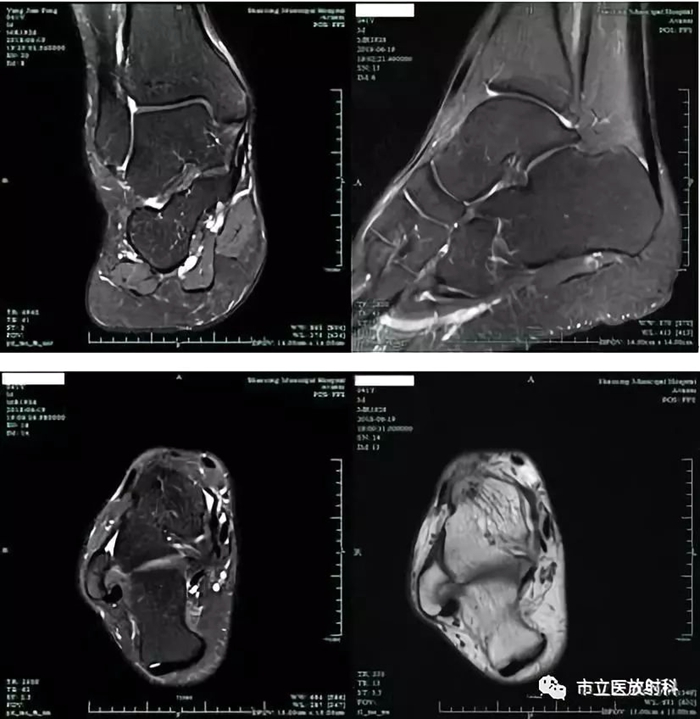 3裸关节MRI图像_副本.jpg 3裸关节MRI图像_副本.jpg